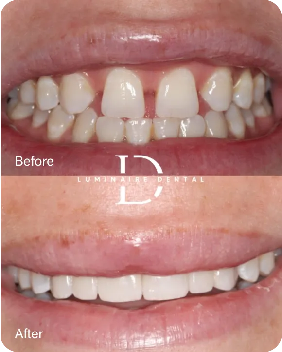 Our Patient Transformed Smiles​