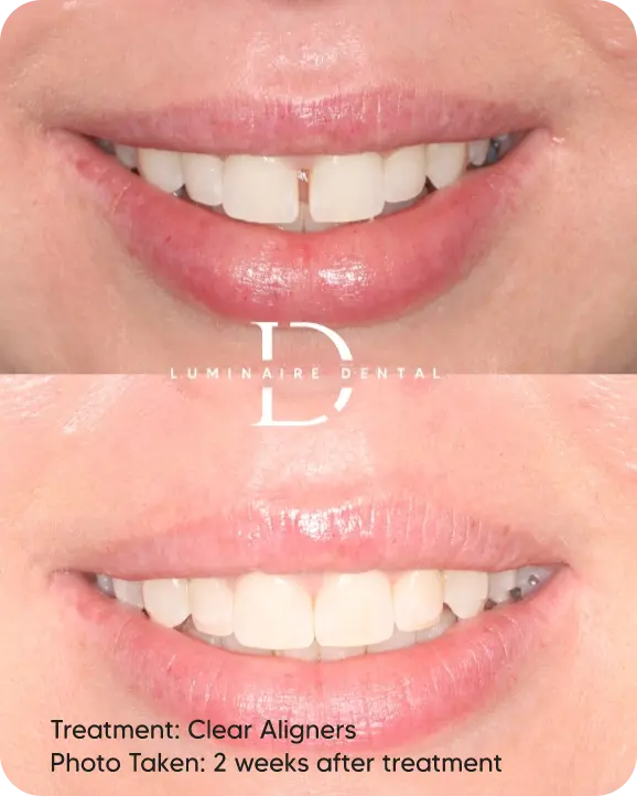 Our-Transformed-Smiles-2