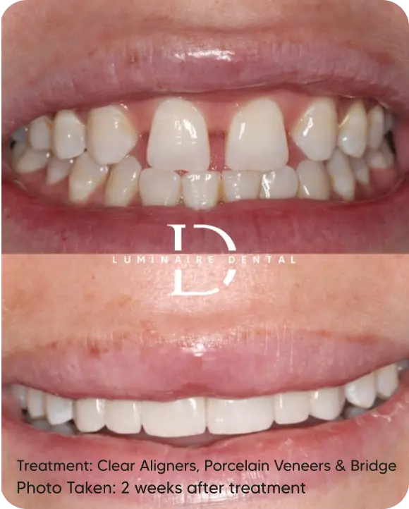 Our-Transformed-Smiles-3