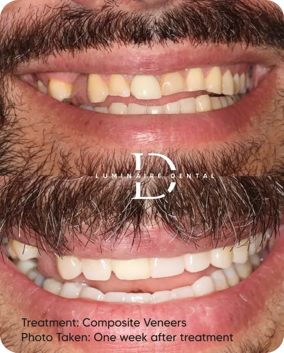 Our-Transformed-Smiles-4