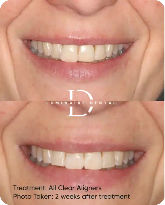 Our-Transformed-Smiles-6-1