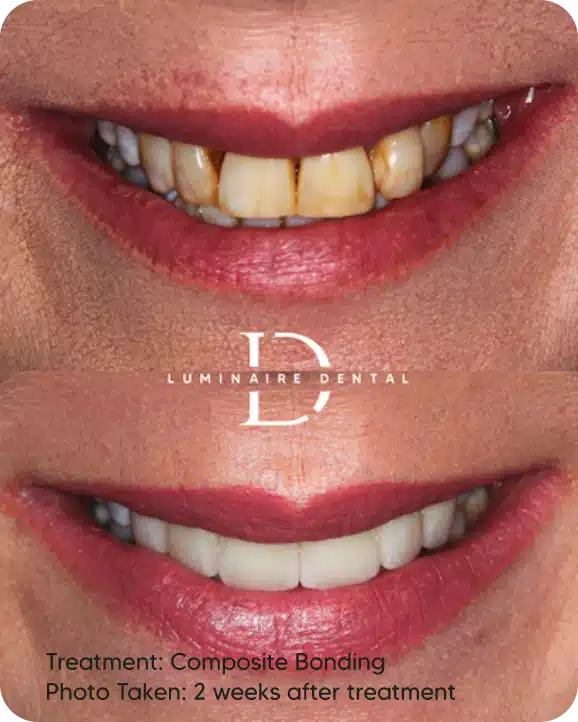 Our Transformed Smiles-7