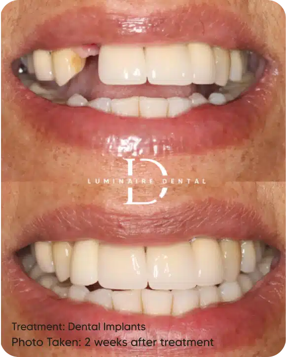 Our Transformed Smiles-8